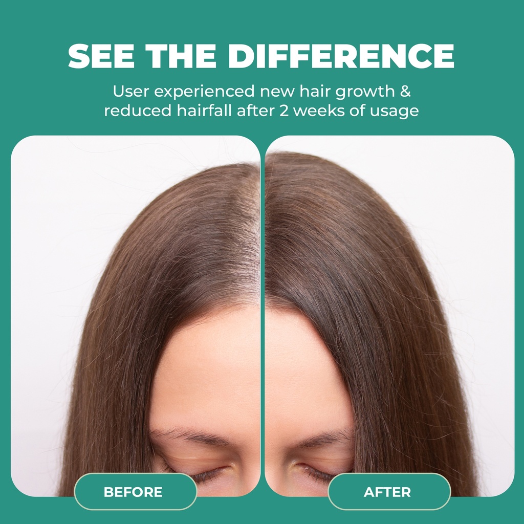 Before After