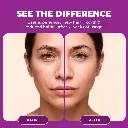 Before After copy.webp