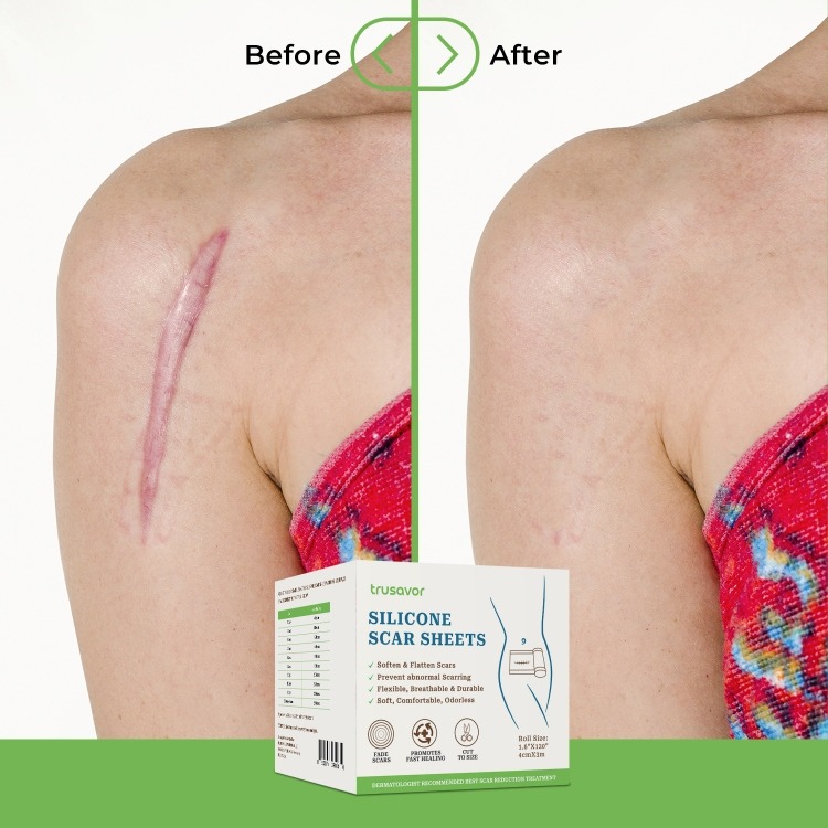 Trusavor Silicone Scar Sheets - Image 8